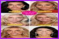 Botox, Implants & More! – Hollywood Life