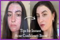 How To Feel Confident With Acne?